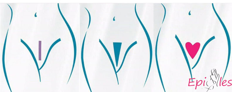 Бразильская депиляция зоны бикини