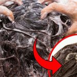 Почему при мытье головы выпадает много волос