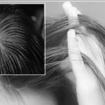 Почему болит кожа на голове у корней волос в отдельных участках